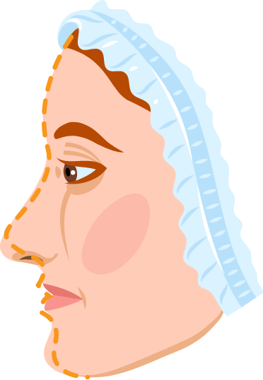 Plastic Surgery Billing Services for Cosmetic and Reconstructive Clinics